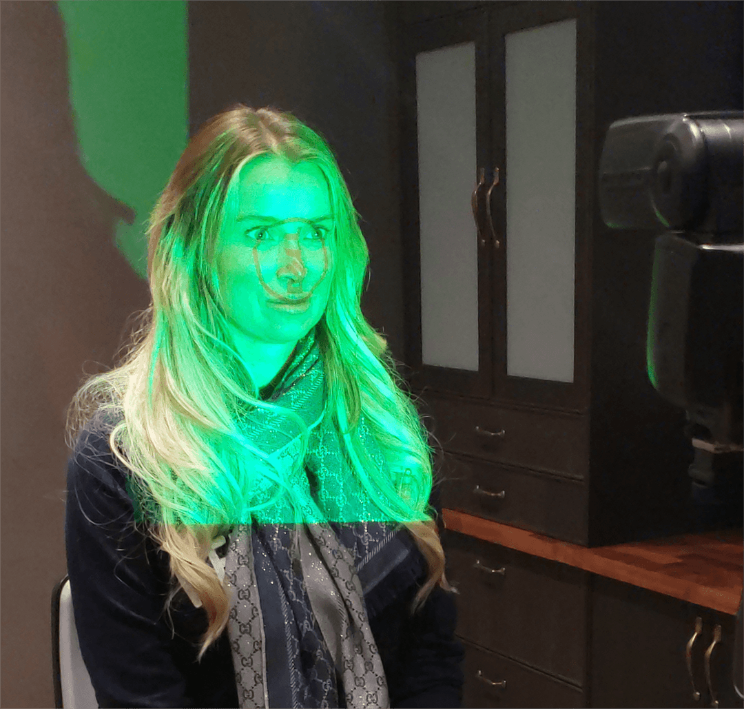 Veneers Tech Gallery 1