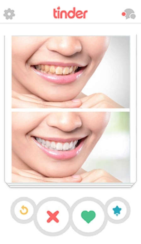 Before After Smile