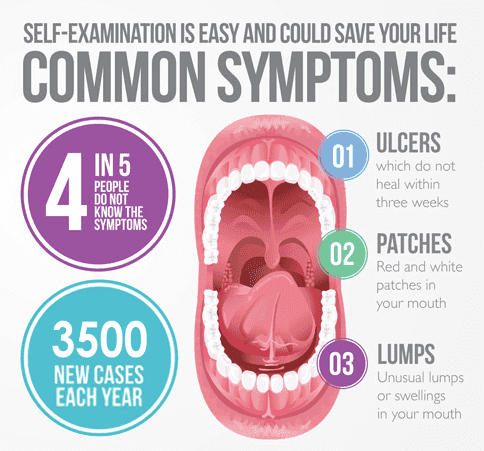 Oral Cancer Common Symptoms